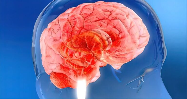 vagusl nerve stimulation,